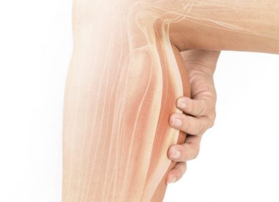 Plantaris-The unknown muscle of the calf, Jersey Shore Sports Medicine